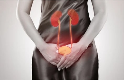 Urinary Tract Infections